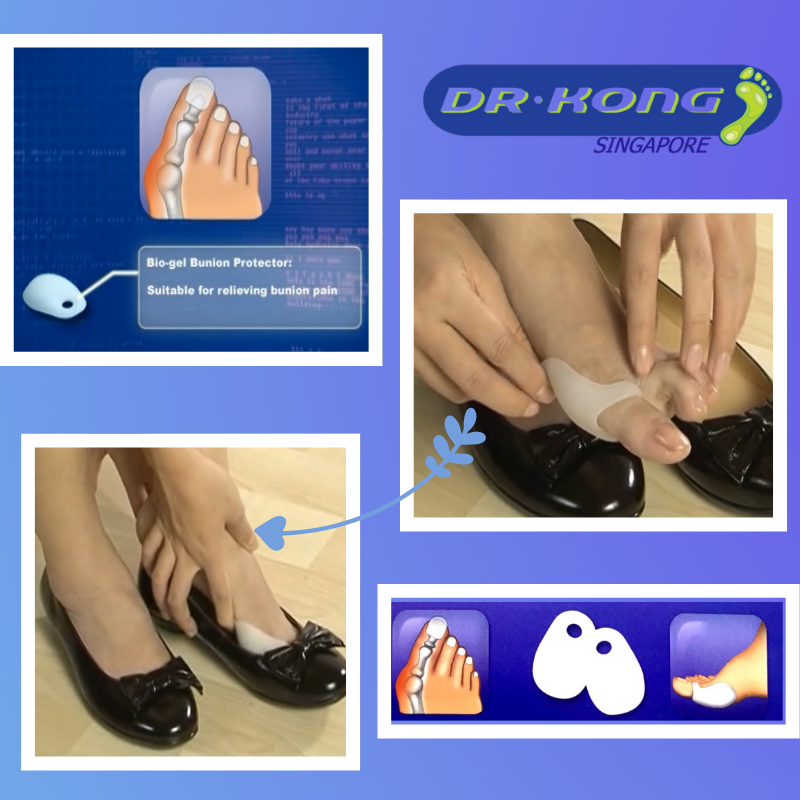 DR.KONG BIO-GEL BUNION PROTECTOR ACCESSORIES DK-DKA10-F