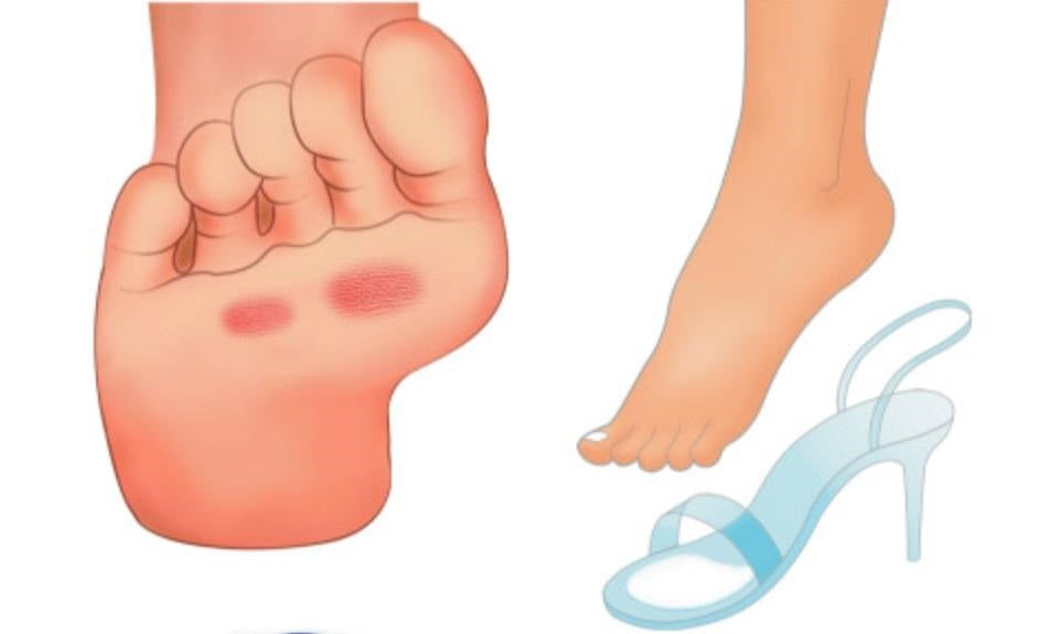 DR.KONG BIO-GEL FOREFOOT CUSHION ACCESSORIES DK-DKA26-F
