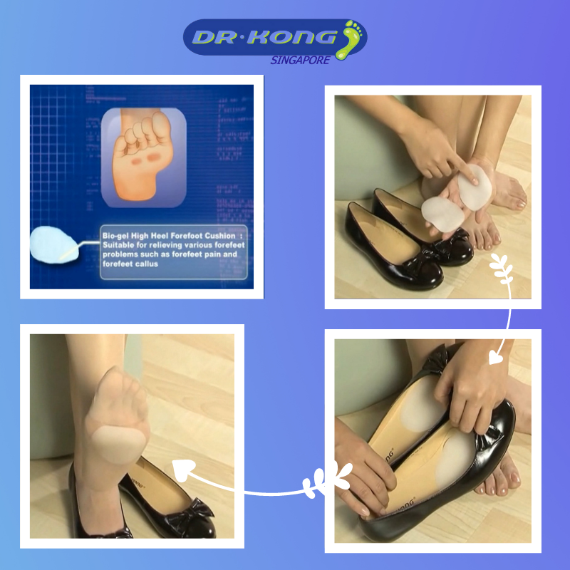 DR.KONG BIO-GEL FOREFOOT CUSHION ACCESSORIES DK-DKA26-F